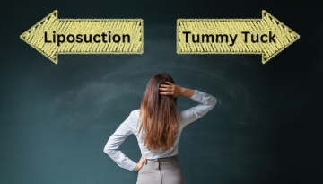 should you get lipo or a tummy tuck