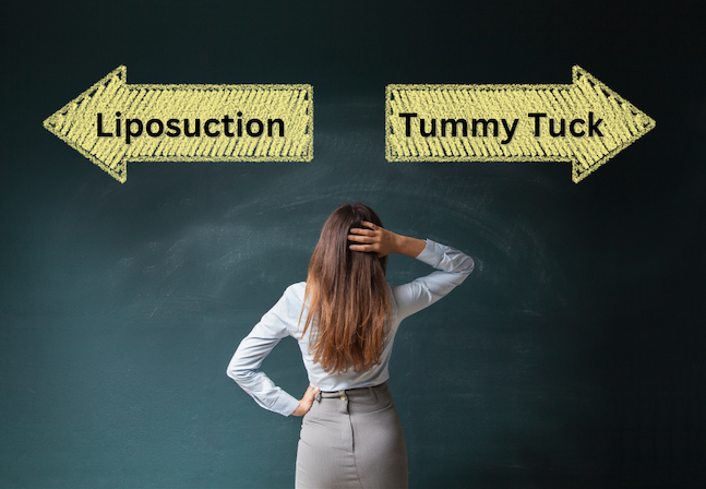should you get lipo or a tummy tuck